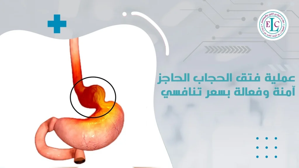 سعر عملية فتق الحجاب الحاجز