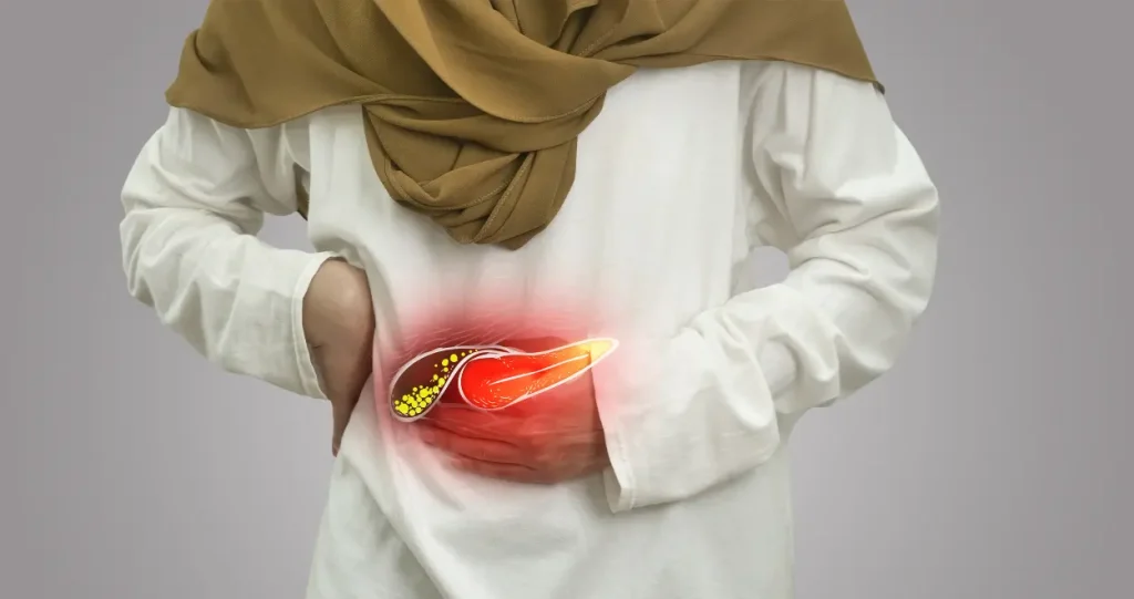 اعراض حصوات المرارة عند النساء